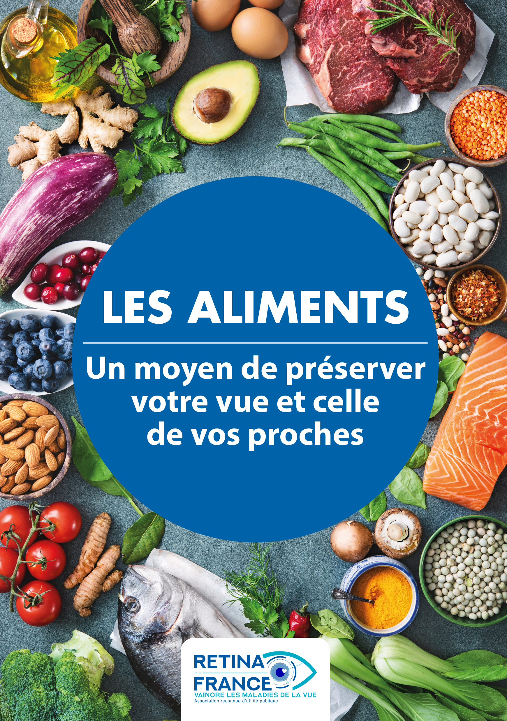 aliments-vue