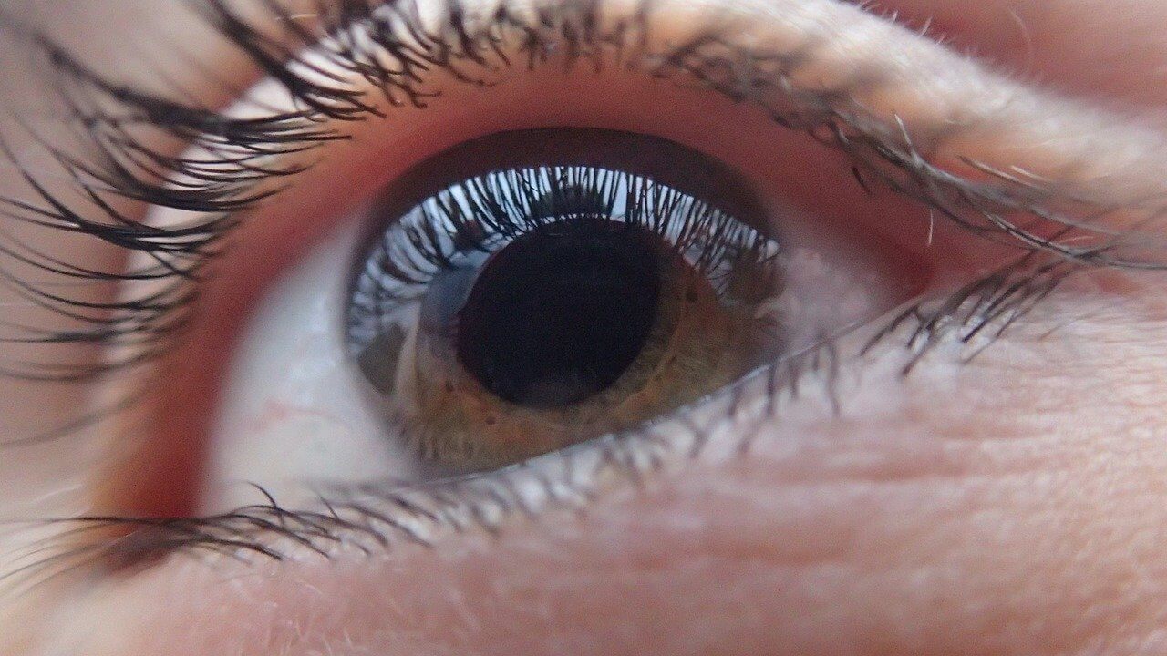 oeil