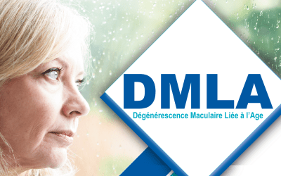 Pour tout savoir sur la DLMA