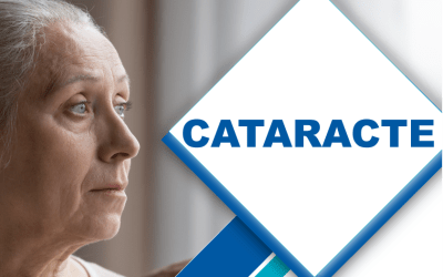 La cataracte