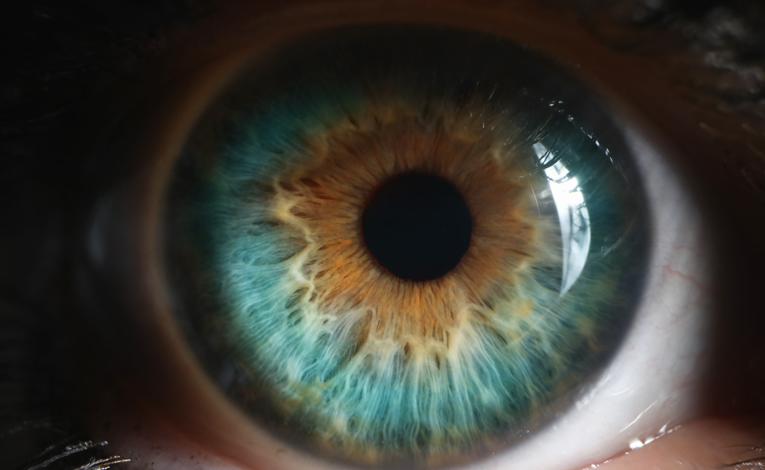 oeil